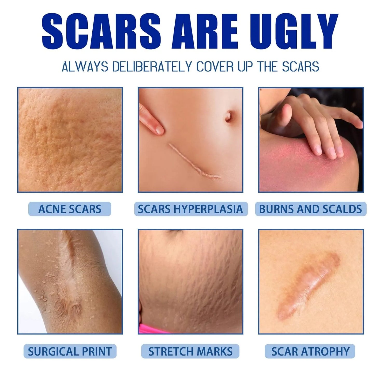 🔥Utolsó nap 50% KEDVEZMÉNY - 🩹Alcuras® Advanced Scar Repair Cream✨