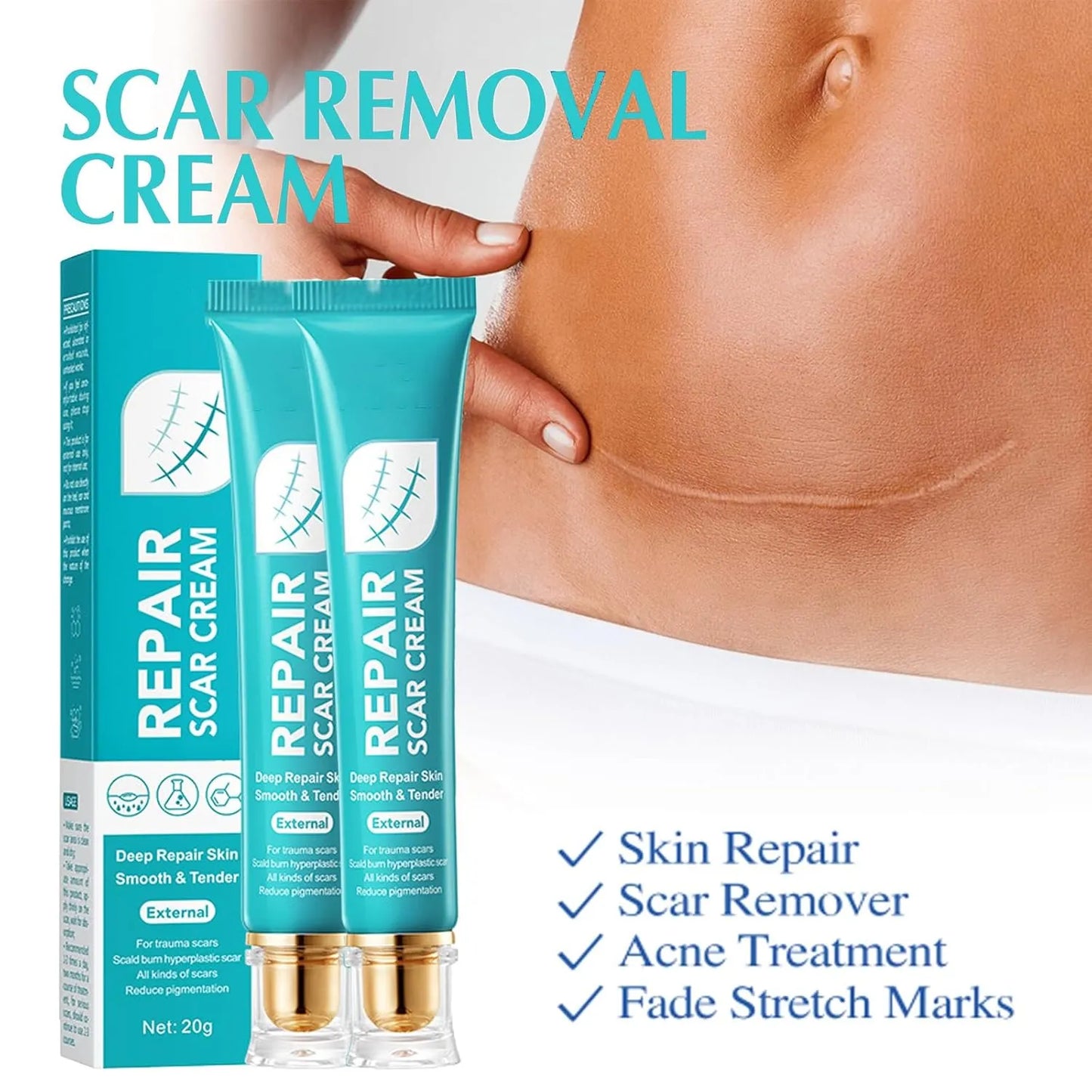 🔥Utolsó nap 50% KEDVEZMÉNY - 🩹Alcuras® Advanced Scar Repair Cream✨