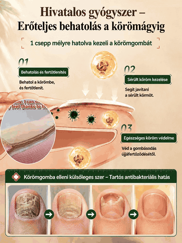 Körömápolási megoldás